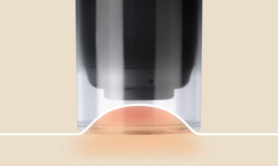 TheraCup: Suction Decompression